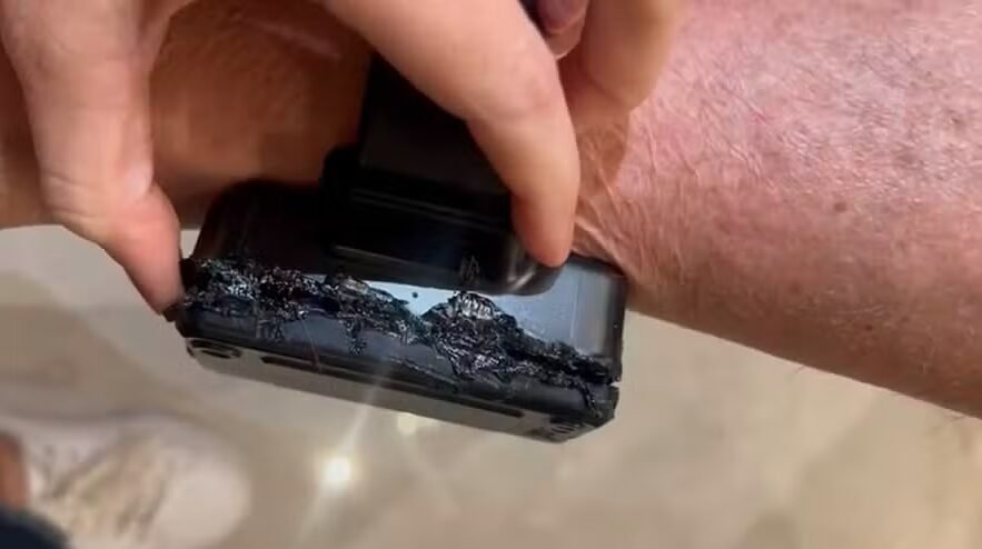 Prisão de Jair Bolsonaro: Defesa alega que ele enfrenta “doenças permanentes” e sequelas “irreversíveis” em decorrência da facada sofrida em 2018.